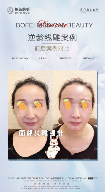 5eda6131069dbd5aca6f94861198aea.png